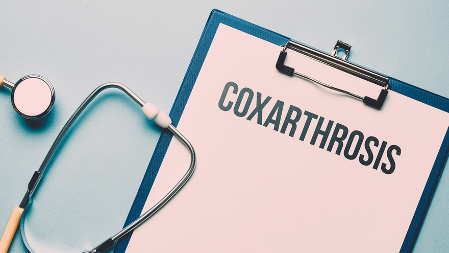 Coxarthrosis