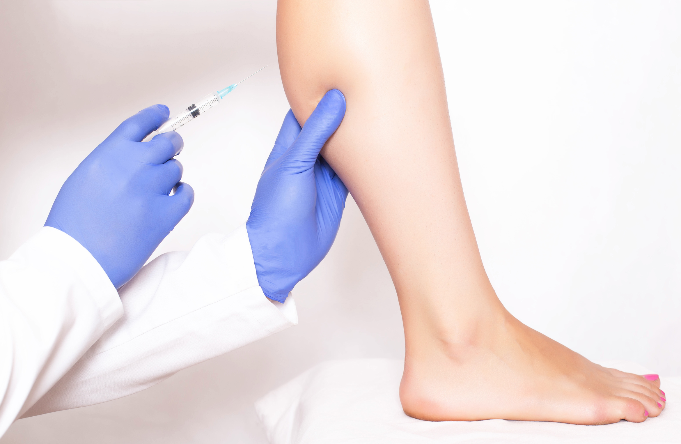 Calf Reduction by Botox Injections