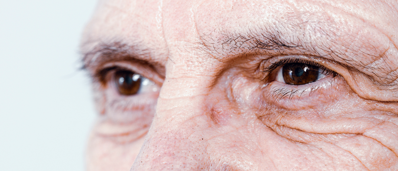 Common Age-Related Eye Problems