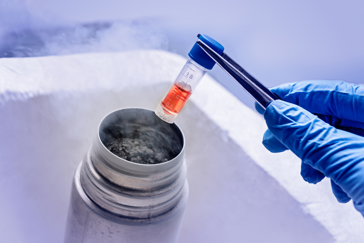 Cryopreservation of Oocytes (includes storage)