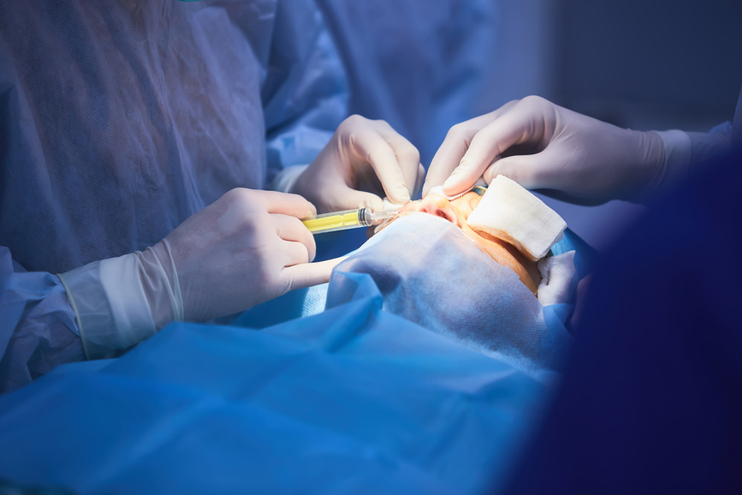 Cirugía de doble párpado no incisional