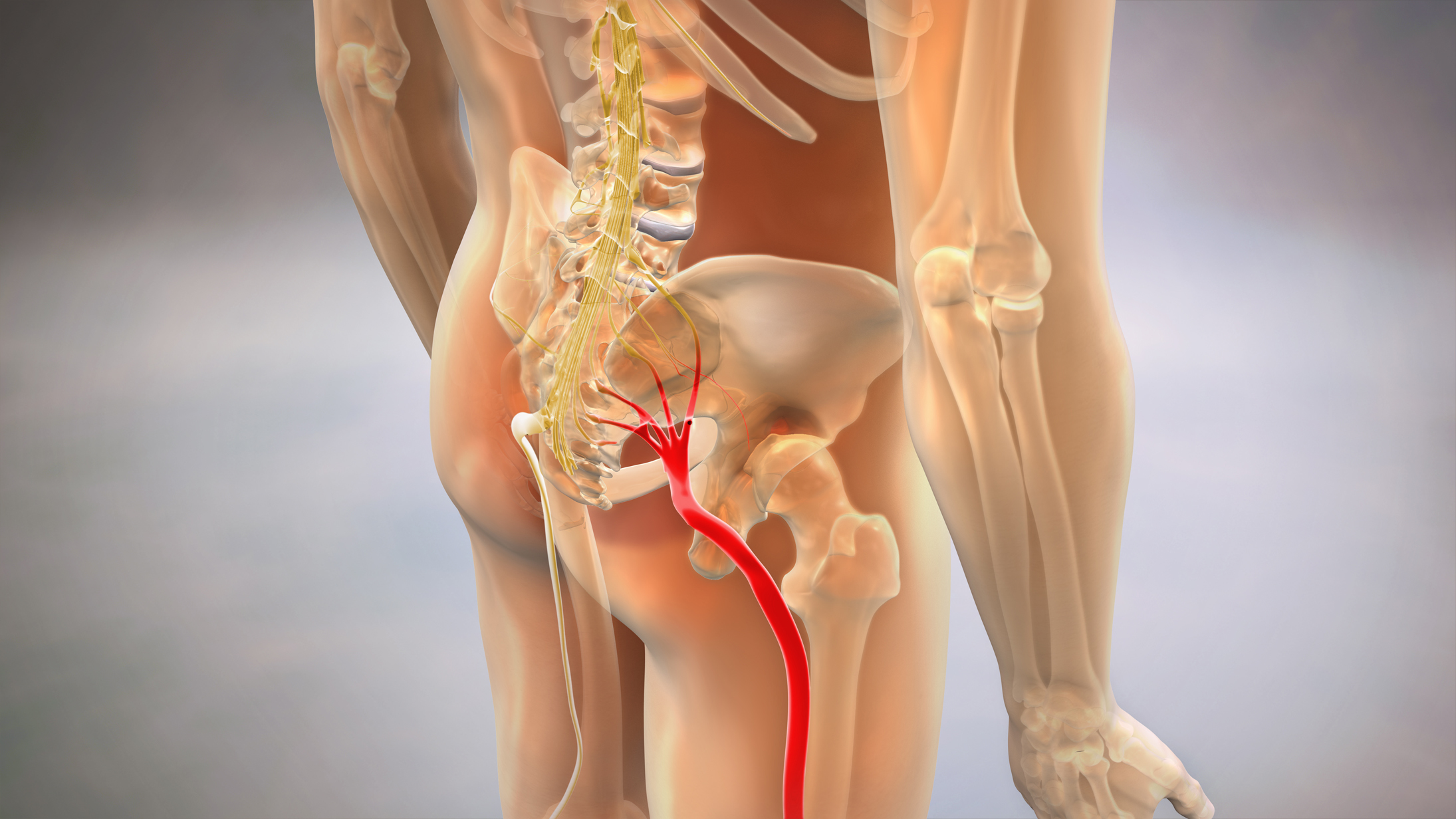 what is sciatica?