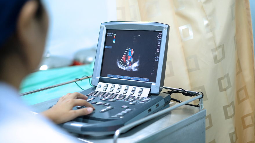 Fetal Echocardiography Equipment 