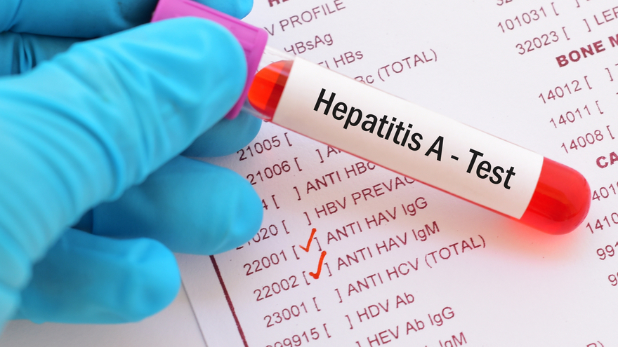 Diagnosis of Hepatitis (ABC)