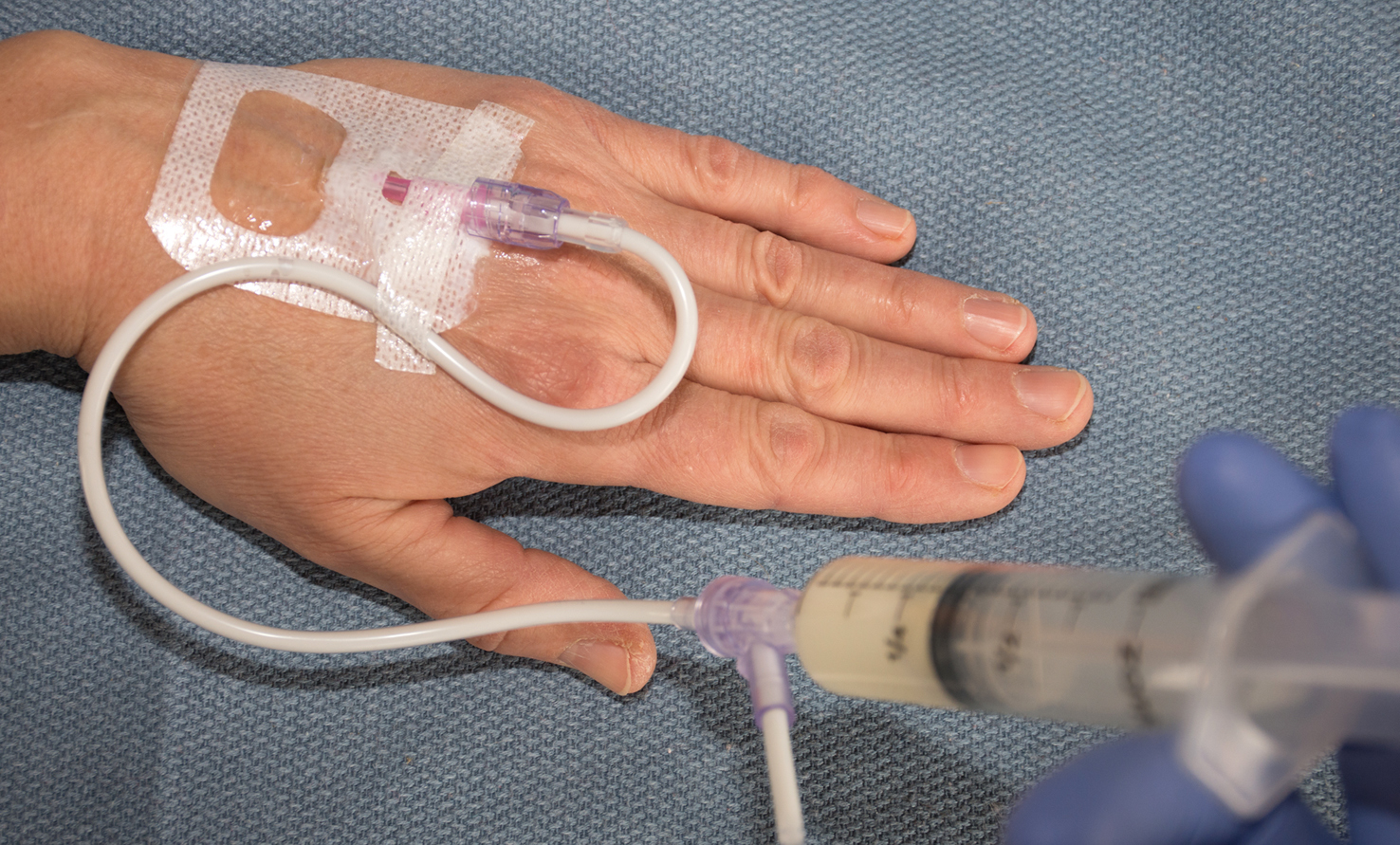 Intravenous Anesthesia