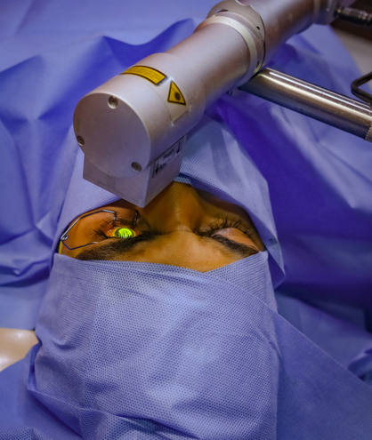 Corneal Refractive Surgery (both Eyes)