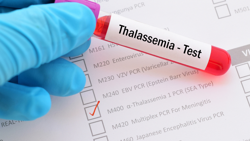 Thalassemia Diagnosis