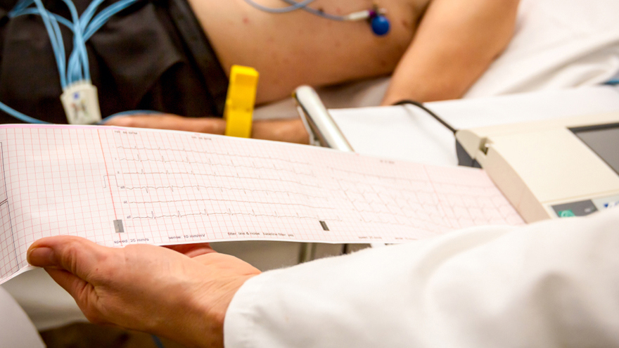 ECG Test