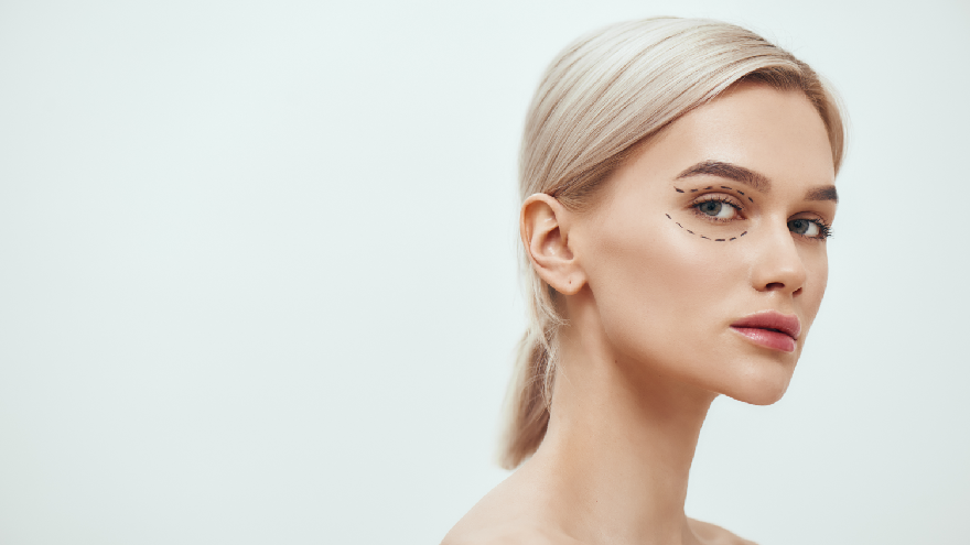 Triple Lower Blepharoplasty