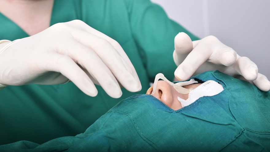 Silicone Implant Rhinoplasty