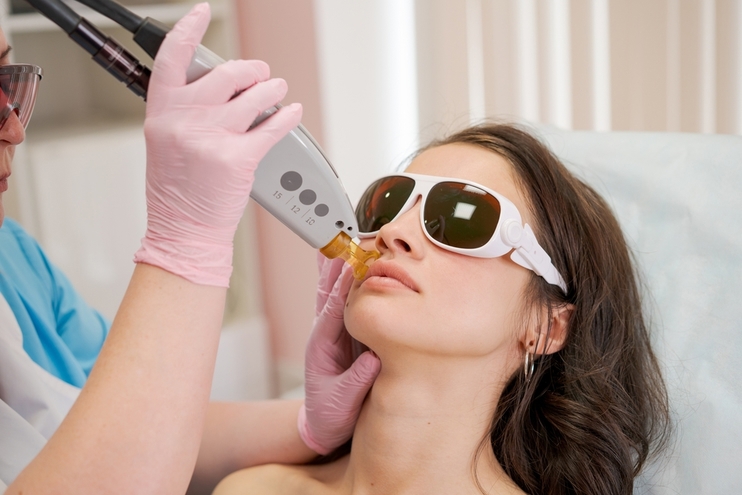 laser therapy