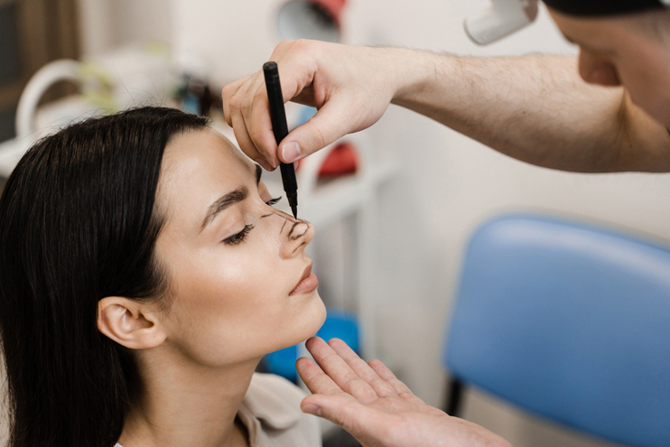 Rhinoplasty untuk Hidung Bulat