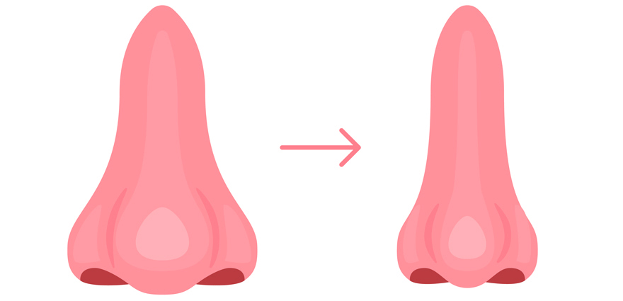 Bulbous Nose