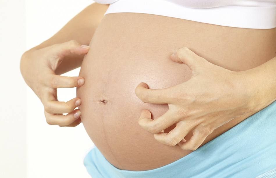 II. Болезни кожи, относительно часто регистрируемые при беременности: