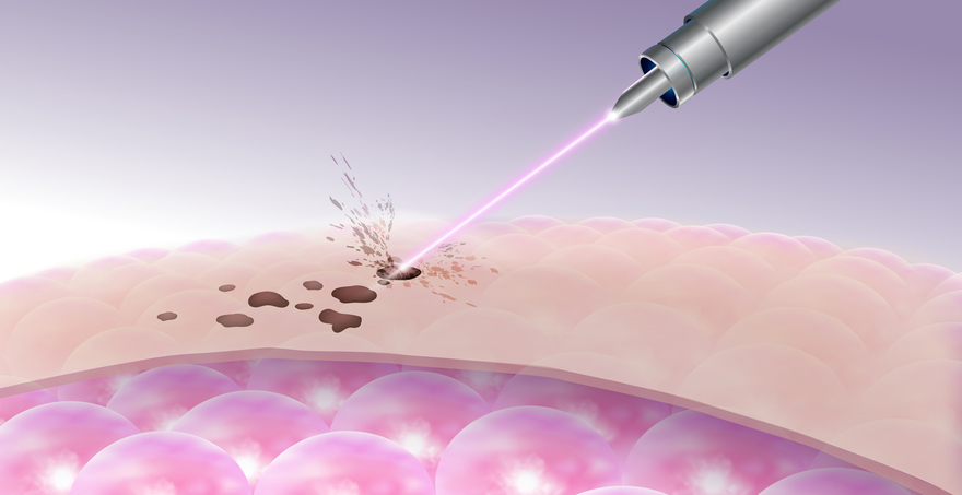 Әдемі жалаңаш қыздарды онлайн көру