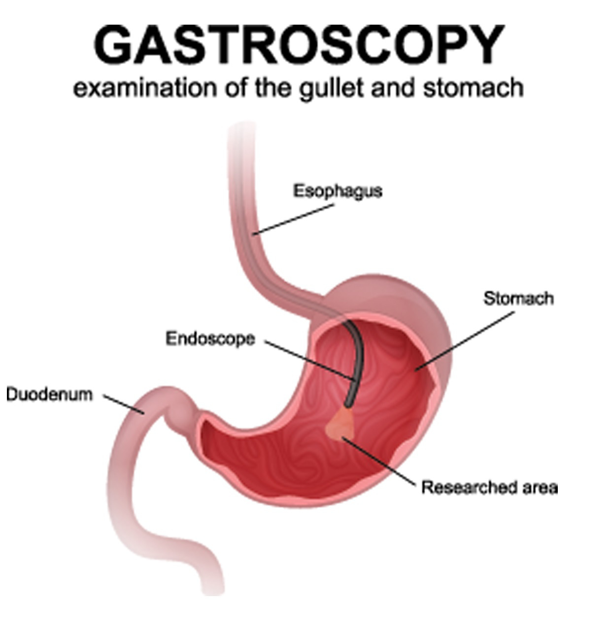 Blog - Diagnosing Gastroenterology Conditions with Imaging Studies