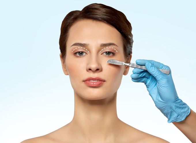 Blepharoplasty
