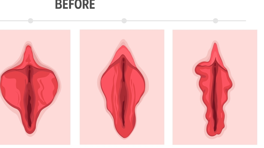 Балапанның қолындағы сик