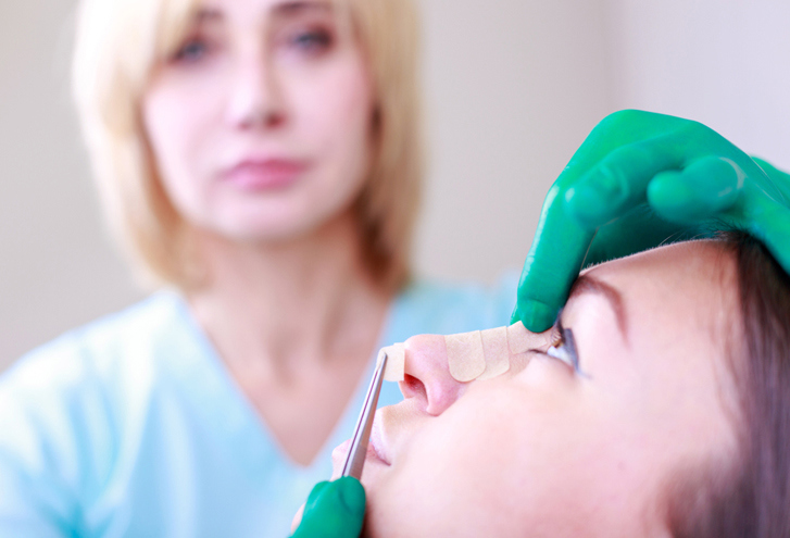 Revision Rhinoplasty