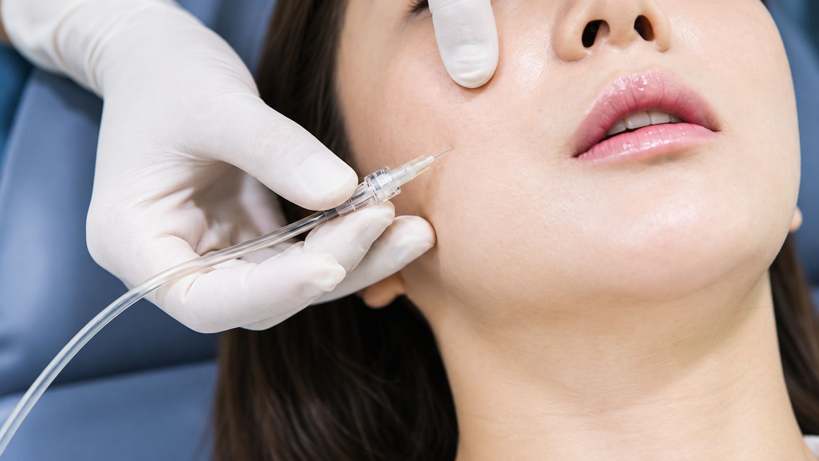Women undergoing Trinity Volume Contouring treatment in a clinical setting.