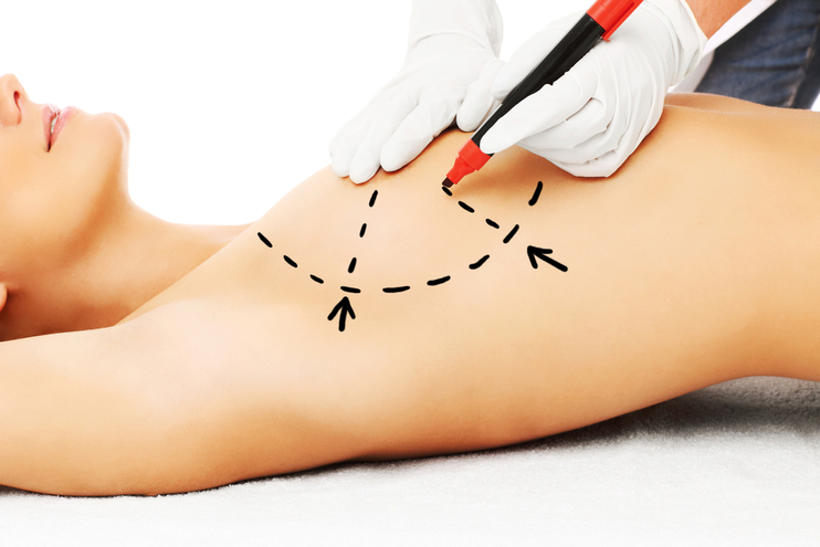 Breast Fat Grafting