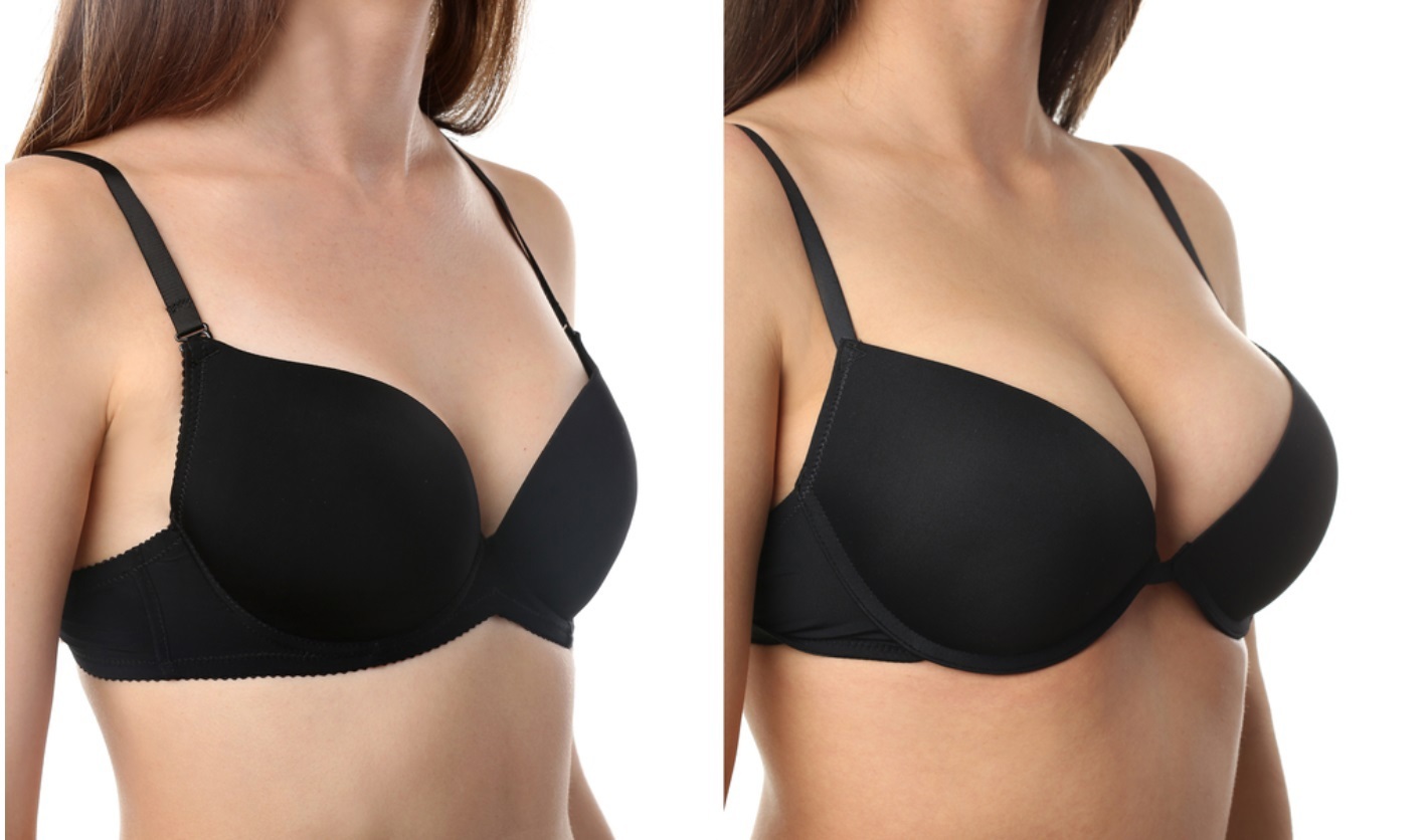 Complete Guide to Breast Reduction Surgery in India