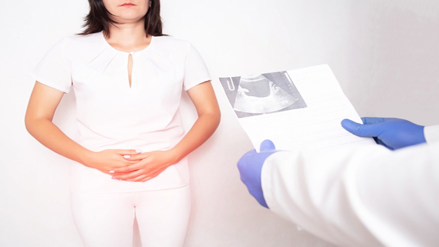 Endometriosis