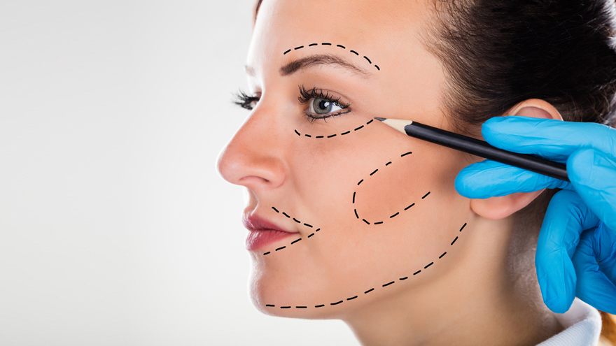 Facial Liposuction