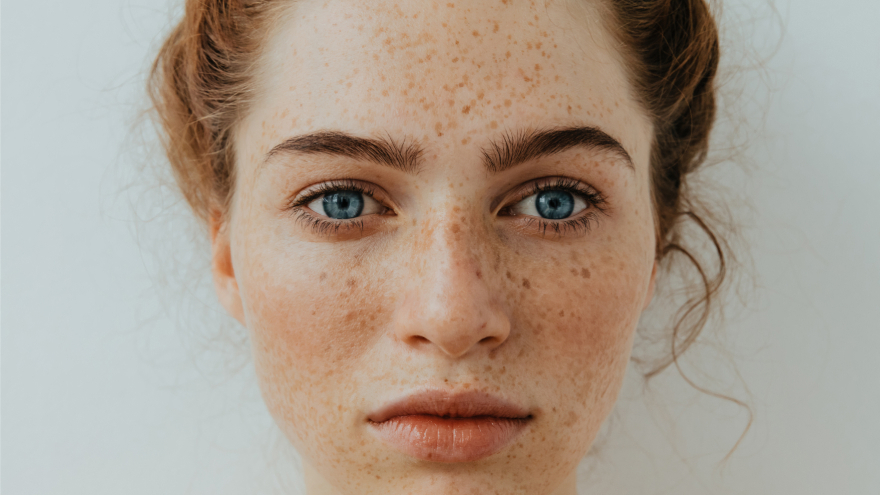 GentleMax Pro Treatment Process