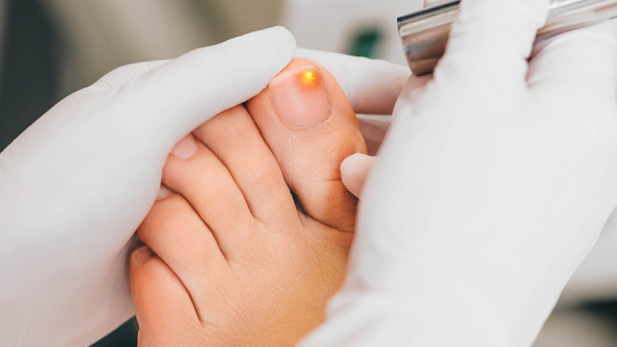 Laser Therapy