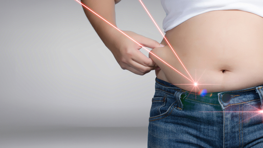 Body Contouring with Accure Laser