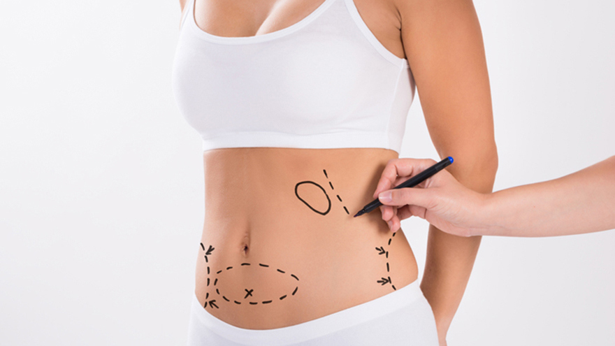 Stem Cells Boost Your Liposuction