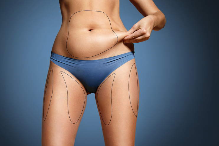 Combining Liposuction