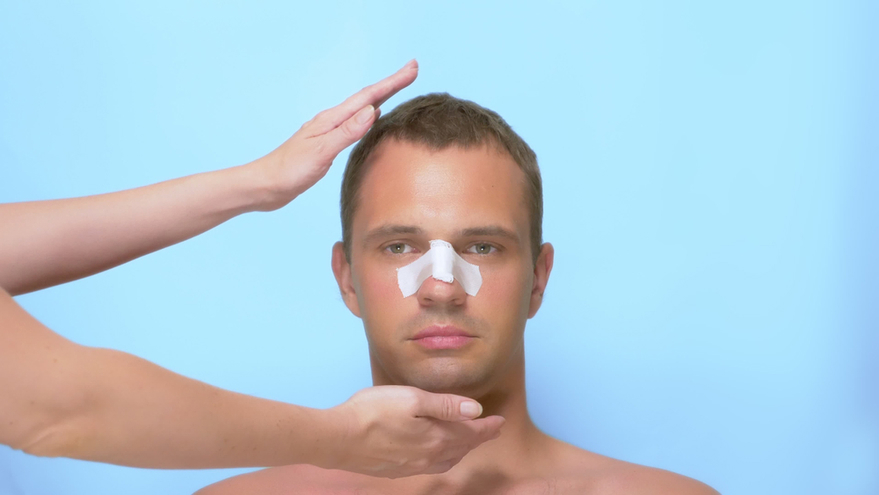 Recovery After Rhinoplasty Surgery