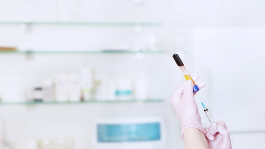 Platelet-Rich Plasma (PRP) Therapy