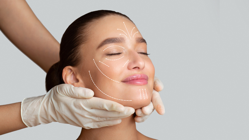 What Is a Facelift?
