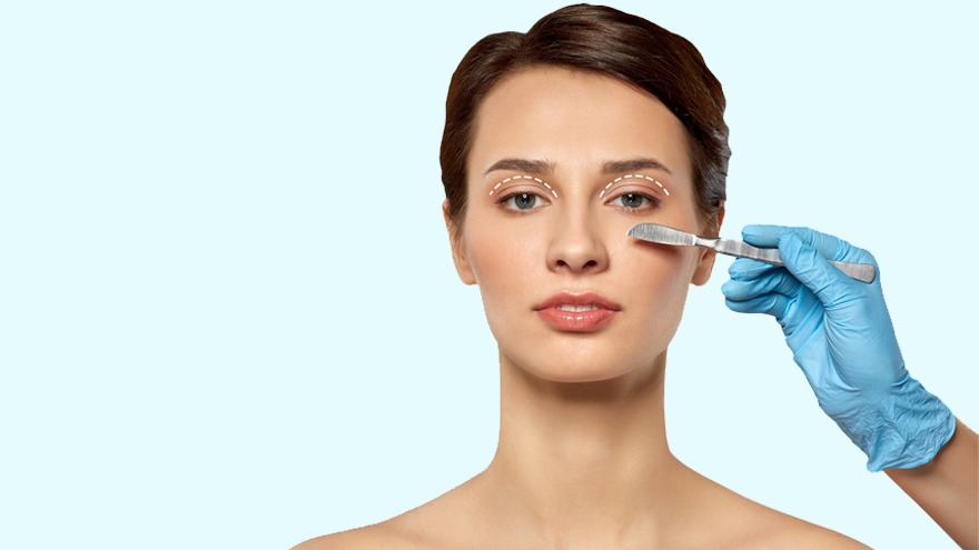 ภาพแสดงการศัลยกรรมเปลือกตา (Blepharoplasty)