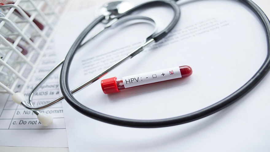 HPV DNA Test