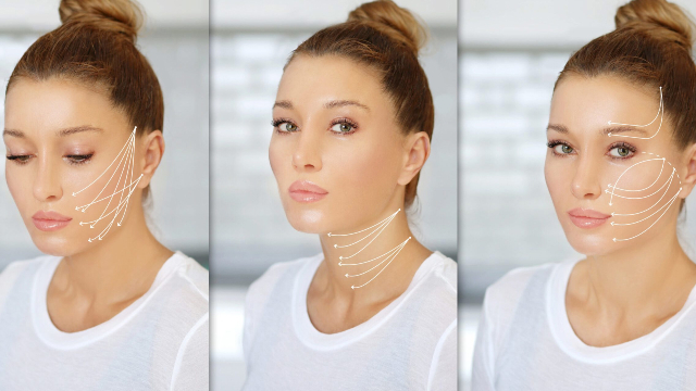 Thread Lifting Treatment Process and Timeline