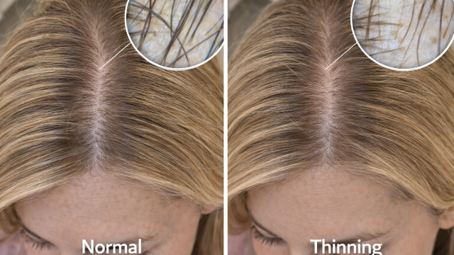 Early Thinning  before and after