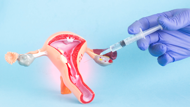 Gloved hand injecting uterus model in medical demonstration
