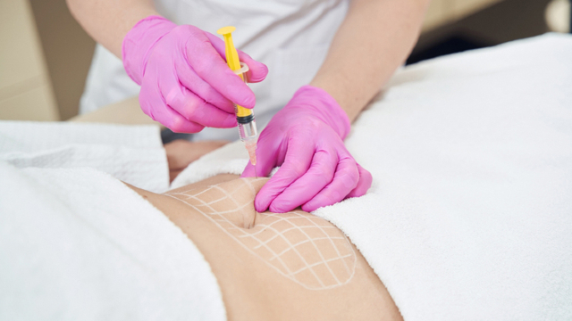 Body Contouring Injection Treatment Process