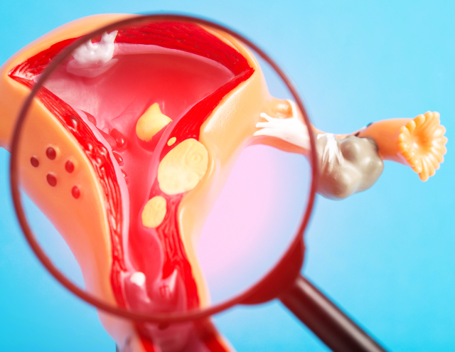 Vaginal Rejuvenation