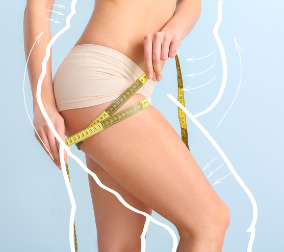 Swelling Timeline for Liposuction