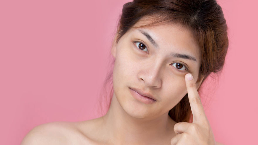 Puffy Eyes with Aesthetic Treatments