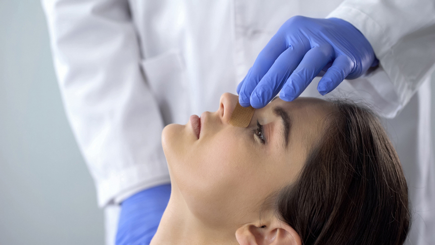 Rhinoplasty 