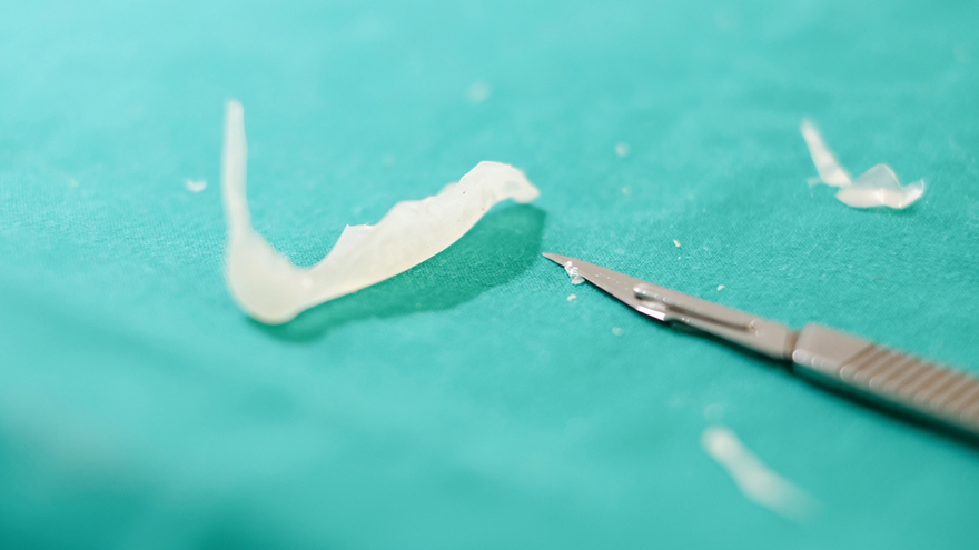 Silicone Implants