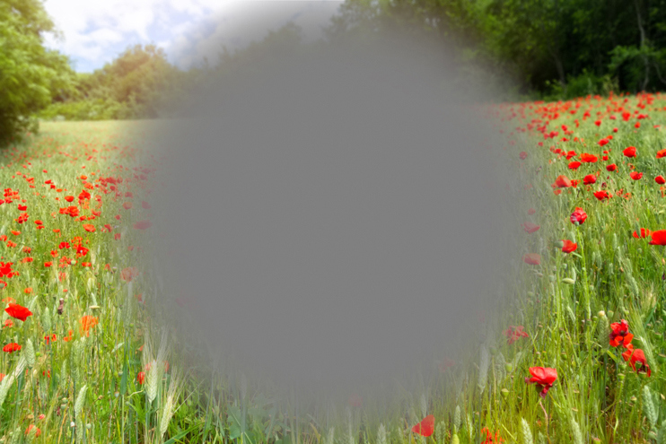 Дегенерация желтого пятна