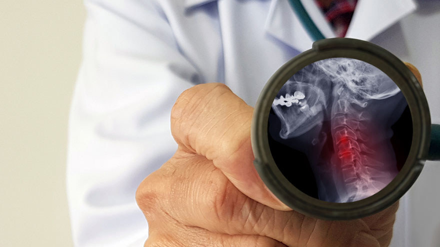Degenerative Disc Disease