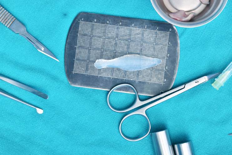 Silicone Implants in Rhinoplasty